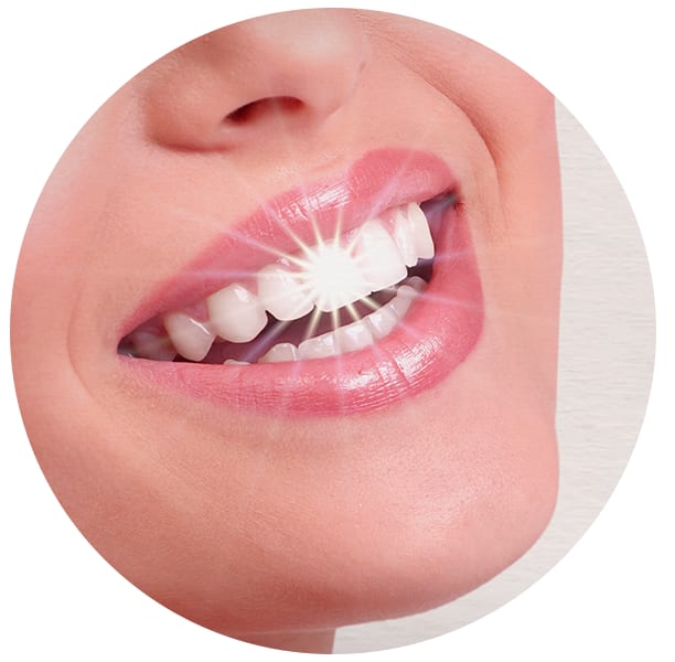 A clinical photograph from the Liphook Smile Studio image library