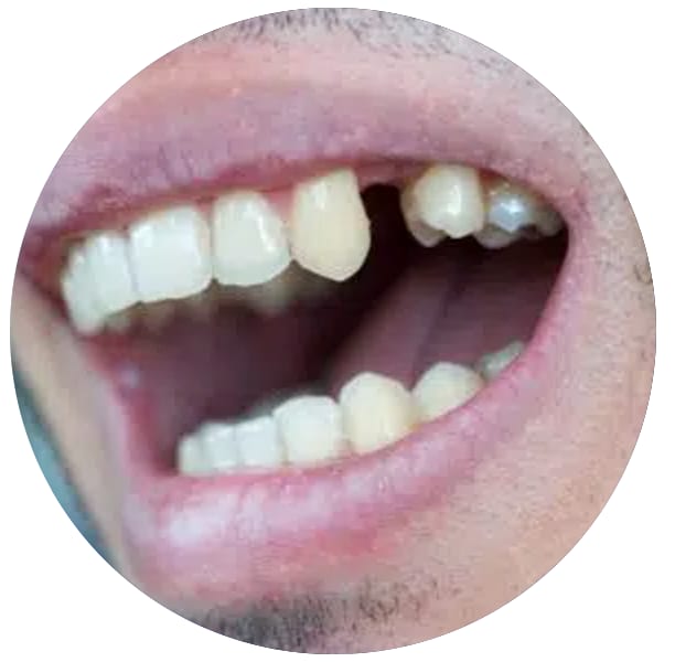 A clinical photograph from the Liphook Smile Studio image library