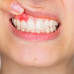 A clinical photograph from the Liphook Smile Studio image library