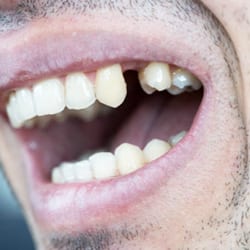 A clinical photograph from the Liphook Smile Studio image library