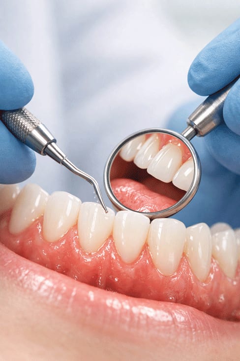 A routine dental examination at Liphook Smile Studio